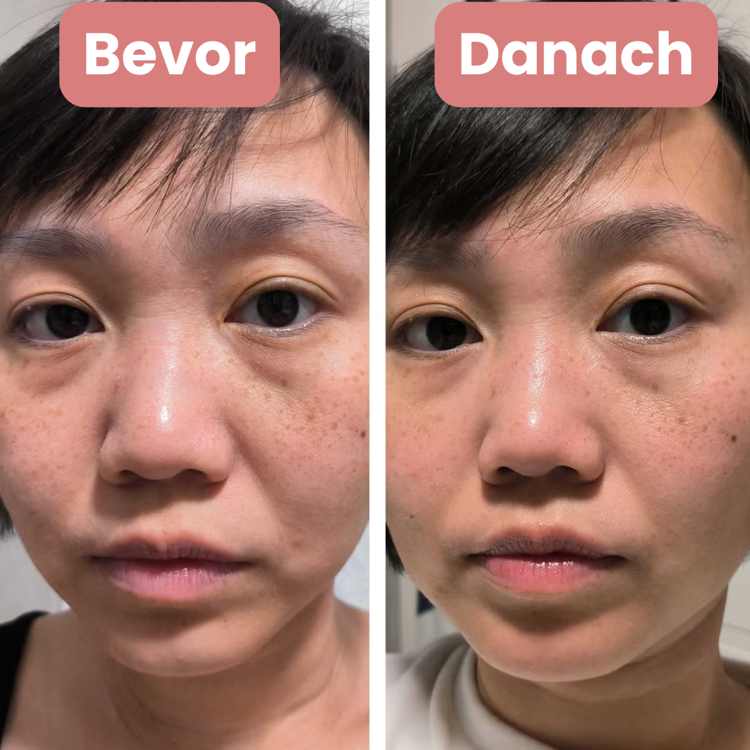 Manial: Mikronadel Pflaster