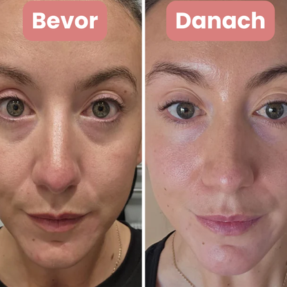 Manial: Mikronadel Pflaster